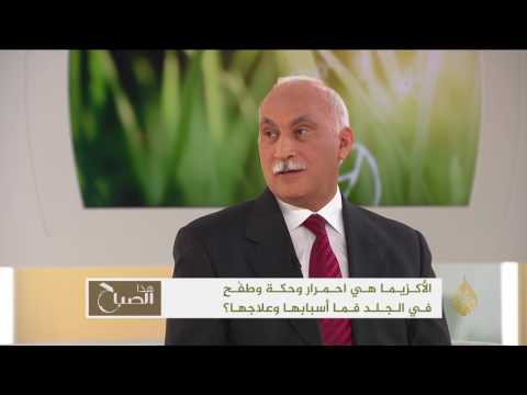 بالفيديو عادل كمال يؤكّد أن الأكزيما تشمل العديد من الأمراض الجلدية