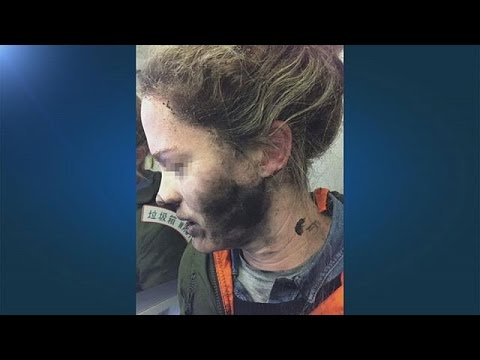 بالفيديو راكبة تصاب بحروق في الوجه بعد انفجار سماعاتها على متن طائرة