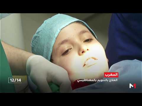 التنويم المغناطيسي طريقة حديثة يعتمدها الأطباء