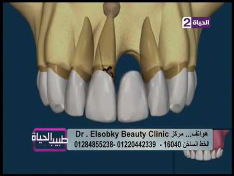 يوضحه برنامج طبيب الحياة