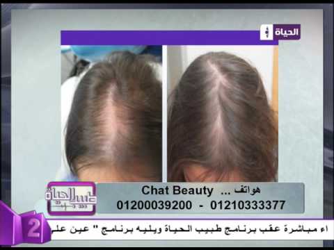 نتائج مبهرة في علاج مشاكل الشعر