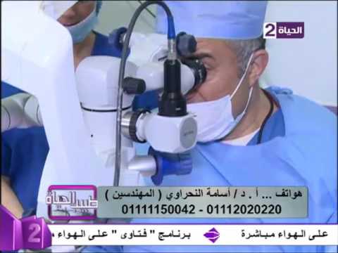 بالفيديو عملية إزالة المياه البيضاء وزرع عدسة وعلاج قصر النظر