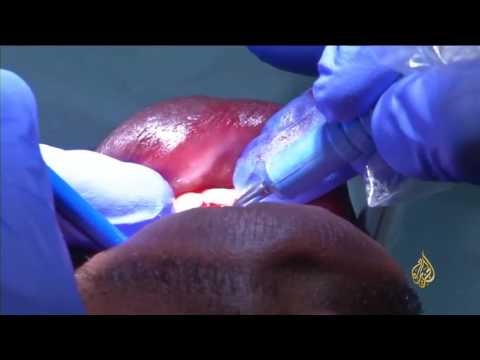 تقويم الأسنان حل لعلاج كثير من العيوب الخلقية