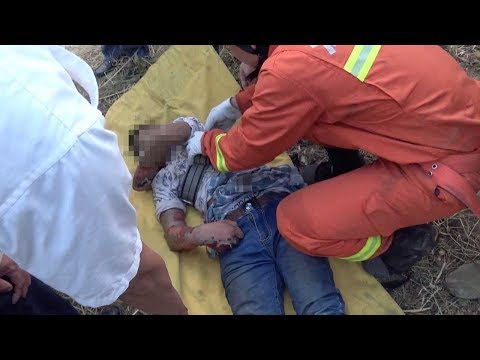 مراهق كاد يفقد حياته بصعقة كهربائية