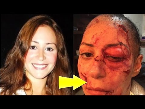 شاهد حقيقة تشويه وجه منة شلبي بطريقة بشعة