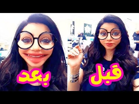 لجين عمران بعد عملية تكبير شفايفها