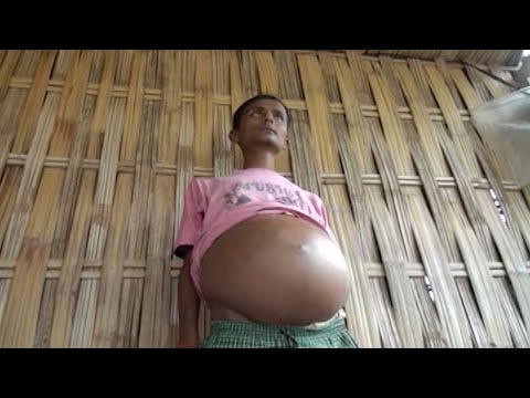 بالفيديو لاعب كرة قدم هندي ينام جالسًا منذ خمسة أعوام