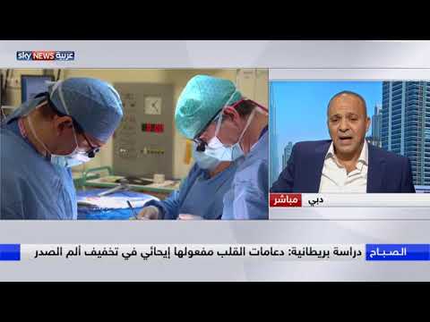 دراسة تشكك بفعالية دعامات القلب بتخفيف الألم