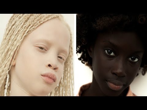 7 توأم فريدون من نوعهم في العالم