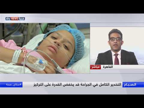 التخدير الكلي يصاحبه ضعف الذاكرة لمدة 4 سنوات