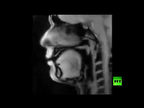 شاهد مايحدث داخل الفم اثناء تحدث الانسان