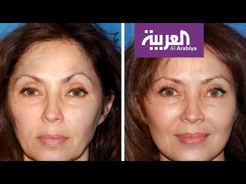 شاهد أبرز الإجراءات التجميلية لتخفيف آثار العمر والتقدم في السن