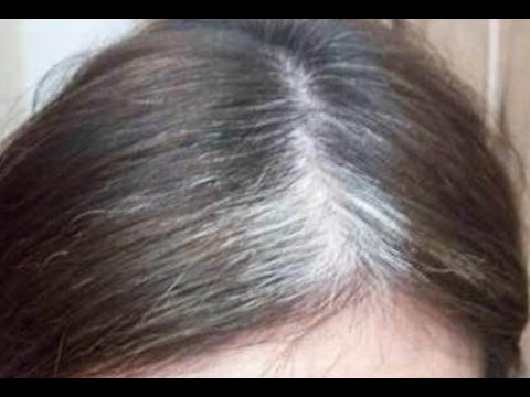 أسهل طريقة لعلاج الشعر الأبيض