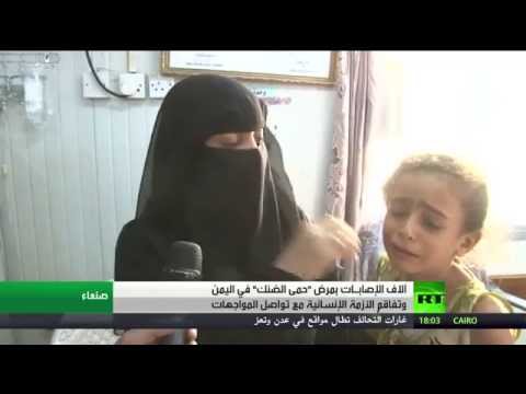 شاهد آلاف اليمنيين مصابون بـحمى الضنك