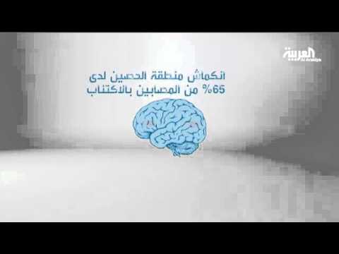 بالفيديو الاكتئاب يؤدي إلى انكماش المخ