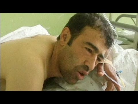شاهد حفل زفاف في أفغانستان يخلف 21 قتيلًا