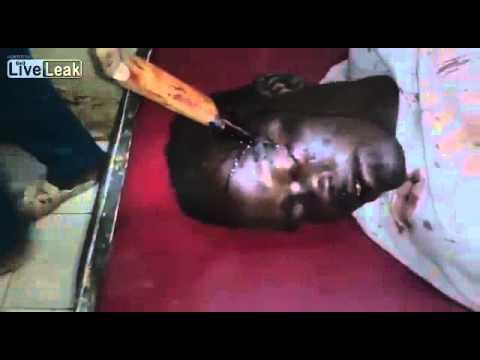 بالفيديو سكين تستقر في رأس رجل ويظل على قيد الحياة