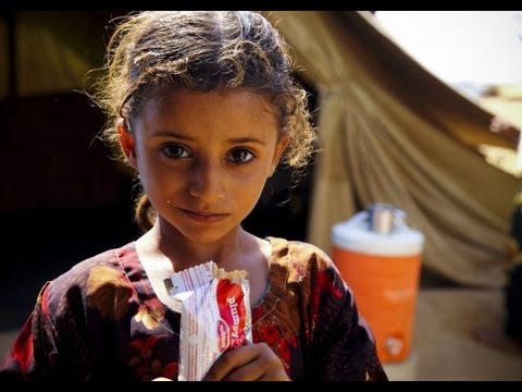 شاهد 6 ملايين يمني على حافة مجاعة