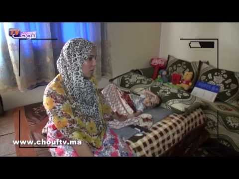 شاهد علاج الطفل الذي يعاني من سرطان في مؤخرته