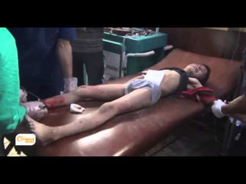 شاهد أطباء يدعون لوقف المجازر في دوما والغوطة الشرقية