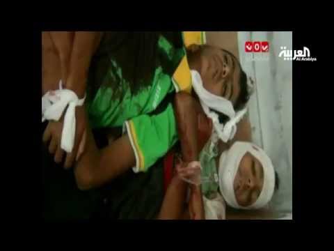 شاهد تعز تعاني الموت