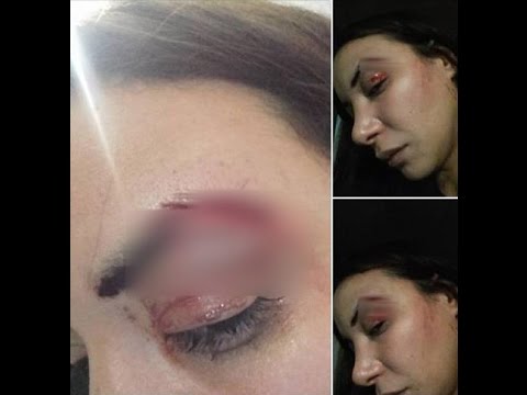 شاهد لبنى أبيضار تتعرض لاعتداء في مدينة الدارالبيضاء