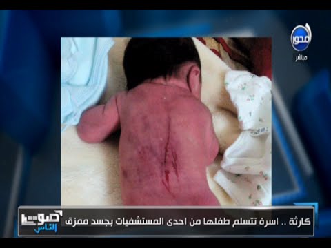 فيديو مواطن يكتشف تمزق جسد ابنه