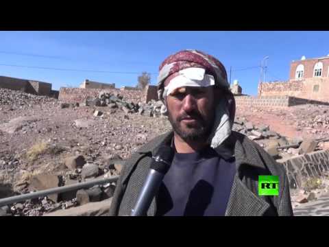 ضحايا جراء غارات جوية على كوكبان اليمنية