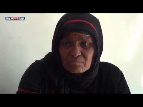 أمراض السرطان في تعز قرح على قرح