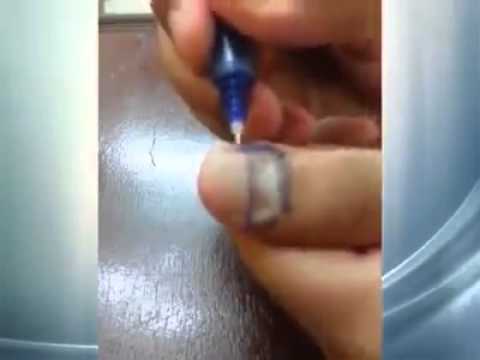 بالفيديو طريقة صينية رهيبة للتخلص من ألم الأسنان