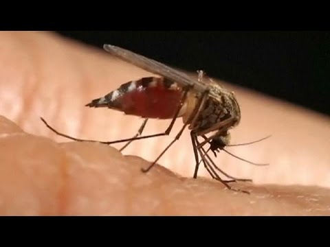 شاهد خبراء أميركيون يؤكدون أن زيكا سبب التشوهات الدماغية للأجنة