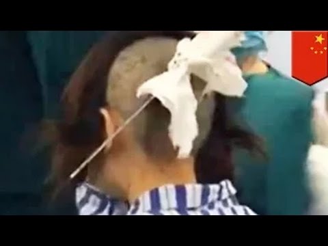 الزوجة تقبض على زوجها وهو يخونها فتغرس سكيناً في رأسه