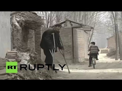 بالفيديو أطول رجل صيني يتمكن من المشي