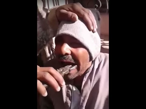 شاهد مصري يخلع ضرسه بـالكماشة