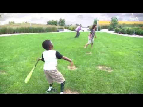 شاهد طفل يمارس حياته بشكل طبيعي بعد عام مع أحد أطرافه