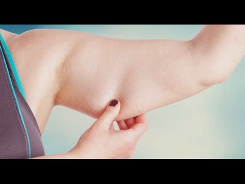 بالفيديو اهمية جراحة شد الجسم بعد عمليات السمنة