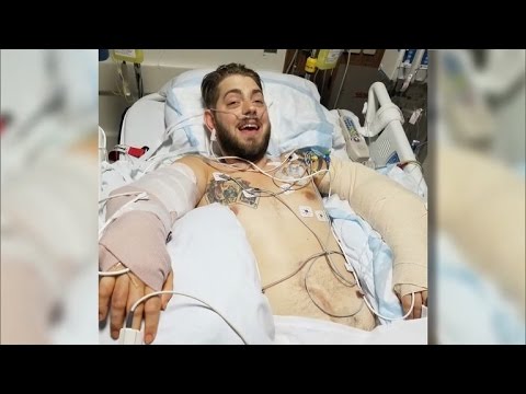 بالفيديو جندي أميركي يحصل على ذراعين بعد 6 أعوام من فقدان أطرافه في الحرب
