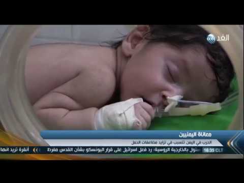 بالفيديو تزايد حالات الوفاة لدى الأطفال حديثي الولادة في اليمن