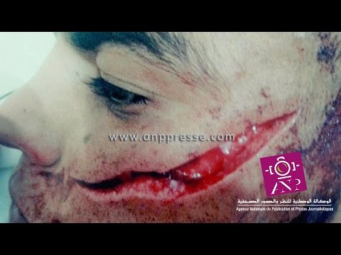 بالفيديو  عصابة تثير الرعب بين سكان مدينة فاس المغربية