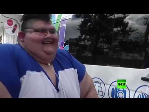 حادث يحول شاب ميكسيكي الي اسمن رجل في العالم