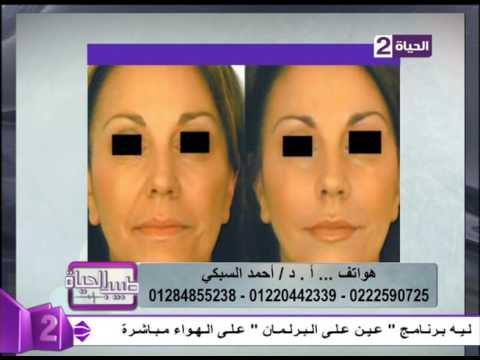شاهد حقن الوجه بالفيلر بدون بنج أو ألم