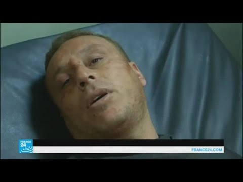 شاهد تفاصيل يرويها مصابون في تفجيرات كوكجلي