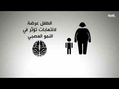 شاهد تأخر نمو الأطفال مرتبط بسمنة الوالدين