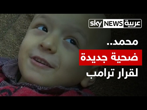 شاهد  طفل أردني مريض ضحية جديدة لقرار الرئيس ترامب
