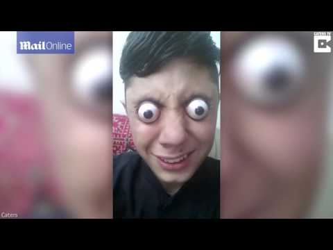 شاهد شاب يُخرج مقلتي عينيه من مكانهما